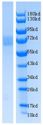 SDS-PAGE analysis of purified Rat GUCY2C(1ug/Line, Reduced).